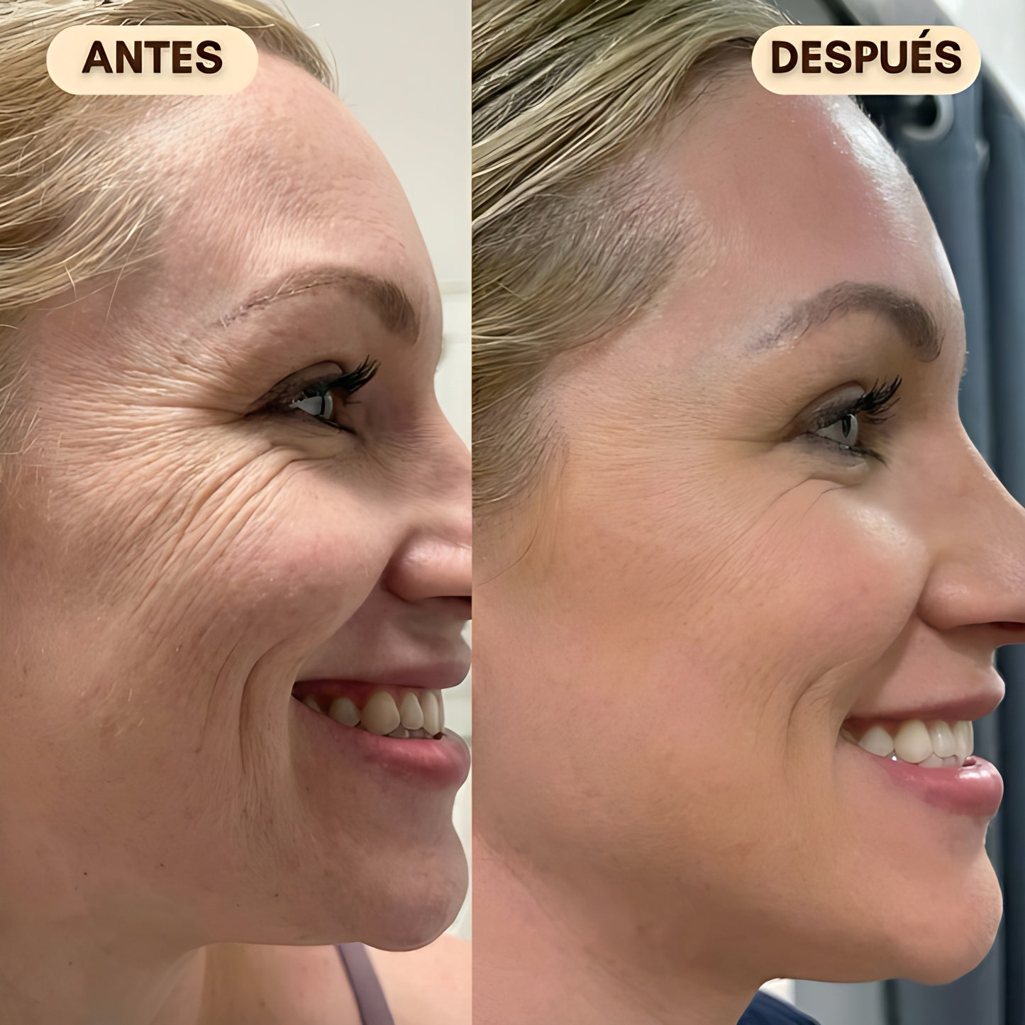 LumiLift™ – Crema Efecto lifting inmediato
